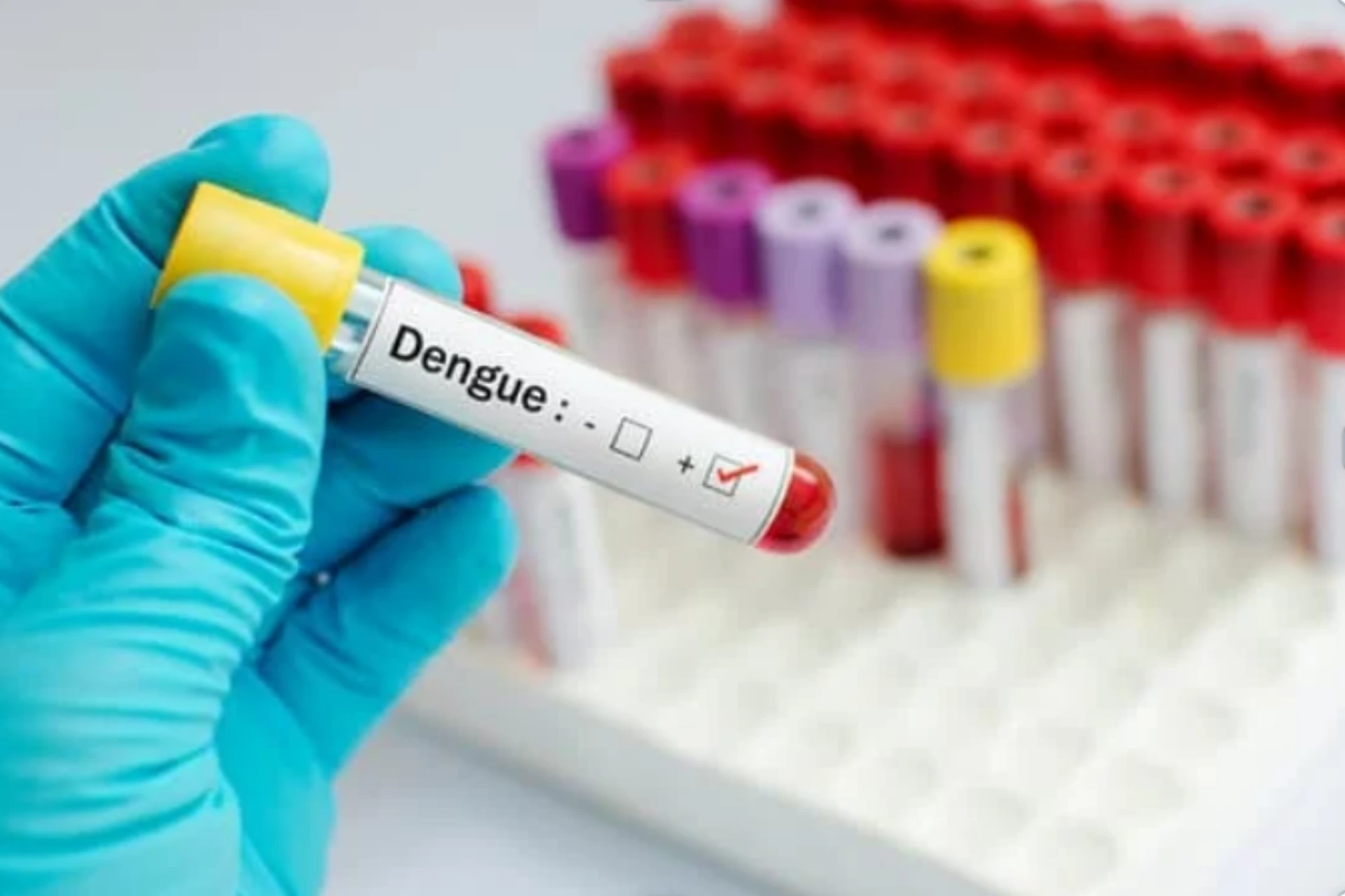 vírus da dengue